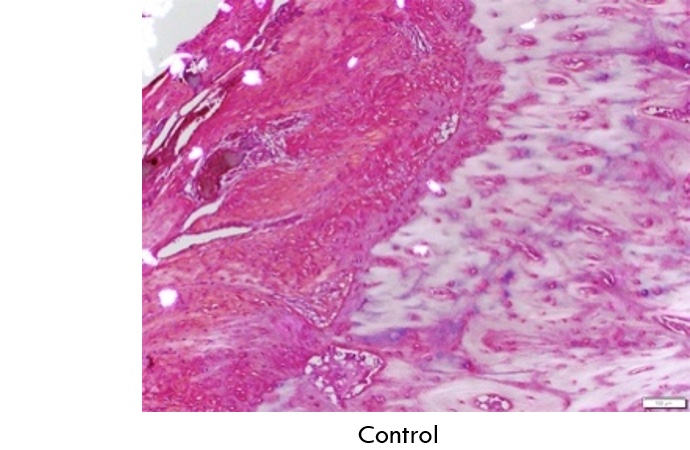 Control - Histological evidence at 12 weeks demonstrating enthesis reformation in the EnFix-treated group, with collagen fibrils extending from bone-to-tendon in a rabbit model.