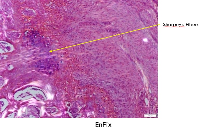 EnFix - Histological evidence at 12 weeks demonstrating enthesis reformation in the EnFix-treated group, with collagen fibrils extending from bone-to-tendon in a rabbit model.