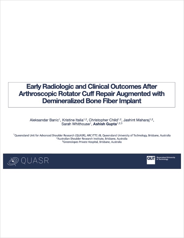 ePoster: Early Radiologic and Clinical Outcomes After Arthroscopic Rotator Cuff Repair Augmented with Demineralized Bone Fiber Implant