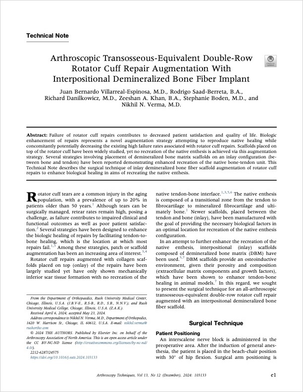 Arthroscopic Transosseous-Equivalent Double-Row Rotator Cuff Repair Augmentation with Interpositional Demineralized Bone Fiber Implant