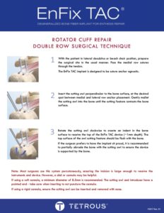 P5017 Rev01 EnFix TAC Rotator Cuff Double Row Surgical Technique