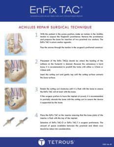 P5021 Rev00 EnFix TAC Achilles Surgical Technique