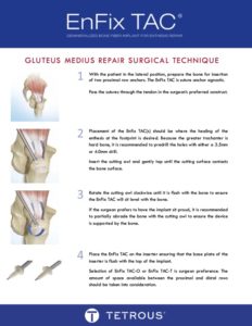 P5024 Rev00 EnFix TAC Gluteus Medius Surgical Technique