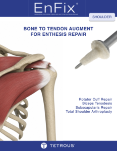 EnFix® Brochure